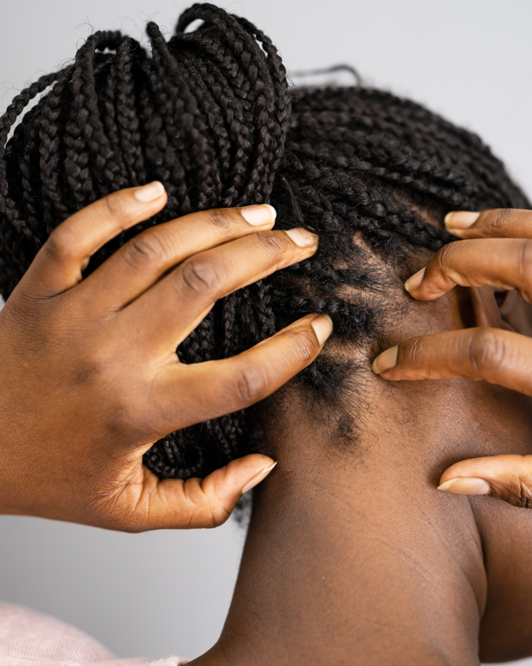 Itchy Scalp &amp; Dandruffs